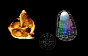 Diagnóstico Cardiovascular